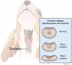 What is the tracheal collapse